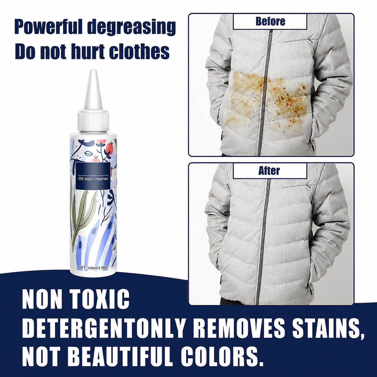 Stain Removal 100ml Sonsel Stain Remover Clothes Strong